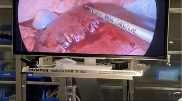 Seeking a solution in surgery