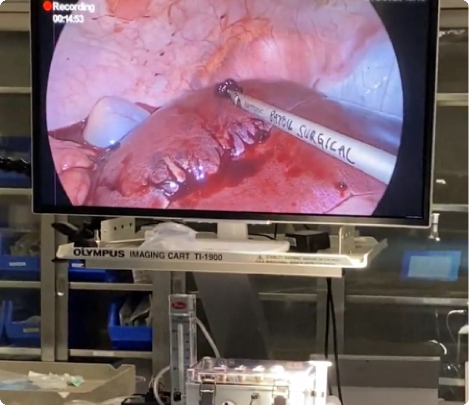 Seeking a solution in srugery